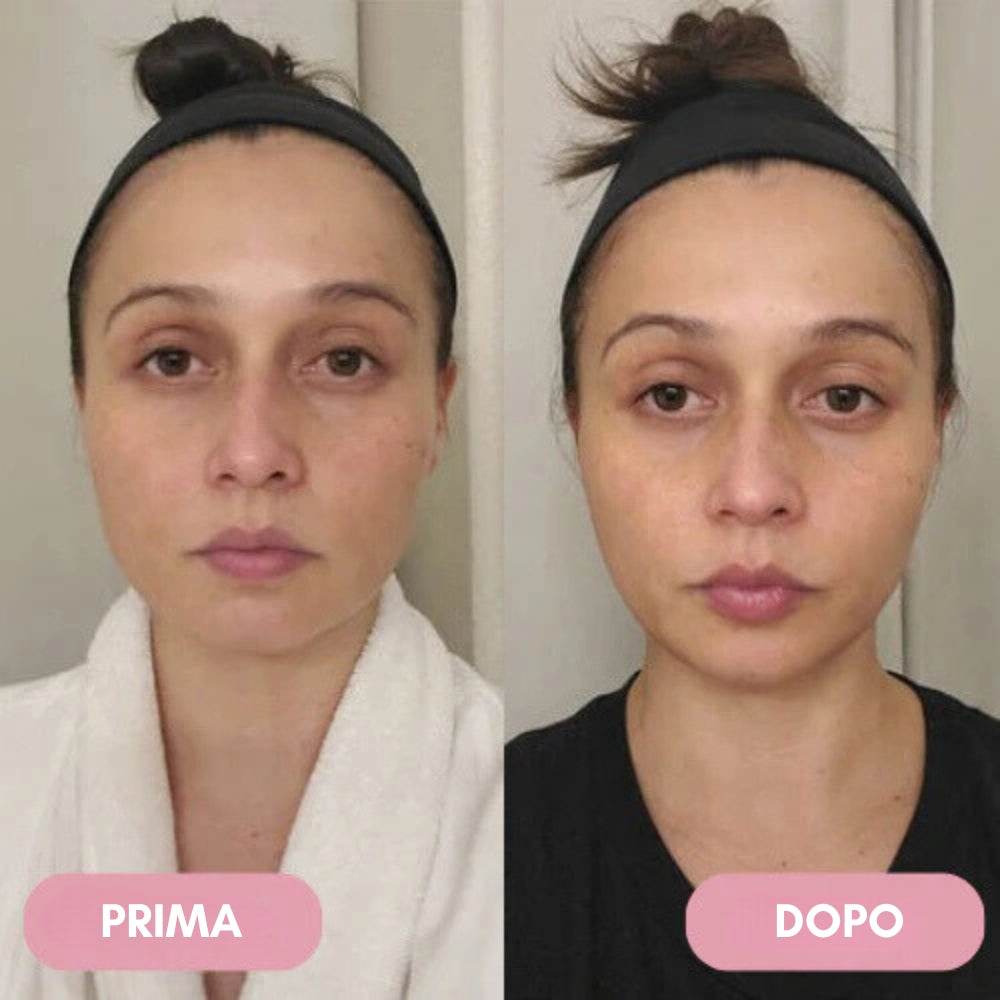 Massaggiatore Facciale a Micro Impulsi